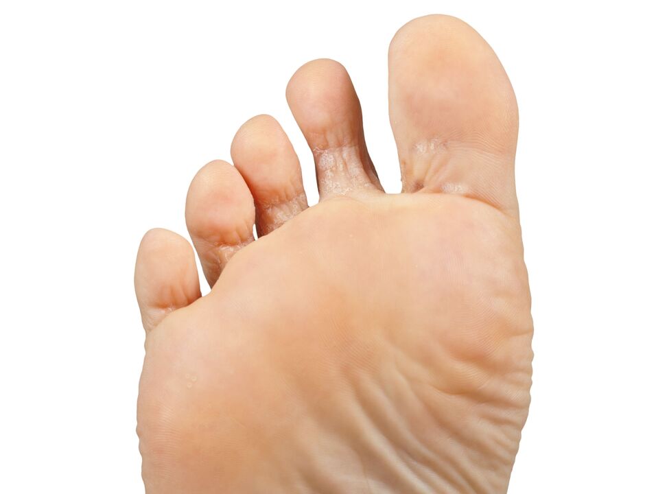 Funer-Good-and-Pair-and-Hektic-Crem-Demyxil