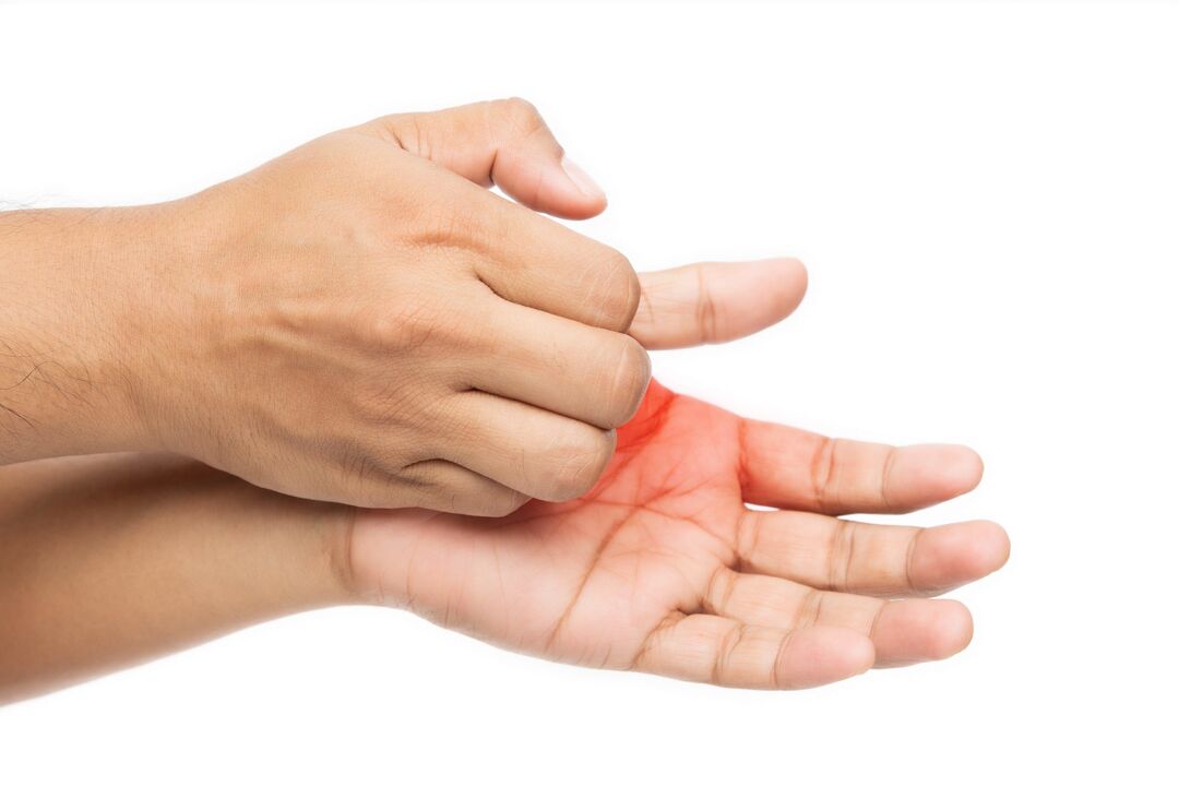 Juckreiz mit Pilz und seiner Behandlung mit Demyxil -Creme